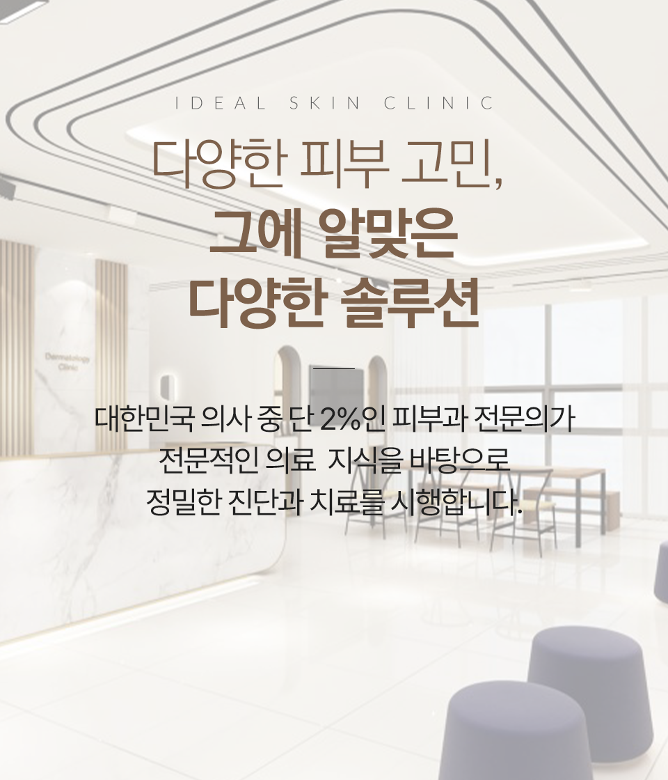 모바일